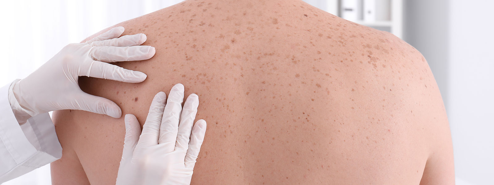 Dermatologic Surgery