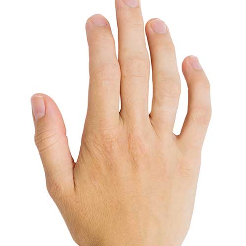 after eczema treatment